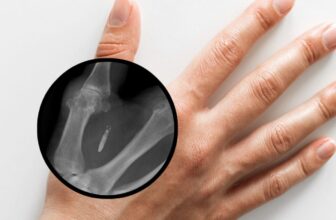 Necessary Subcutaneous Microchips for Staff Might Quickly Be Banned in Washington State